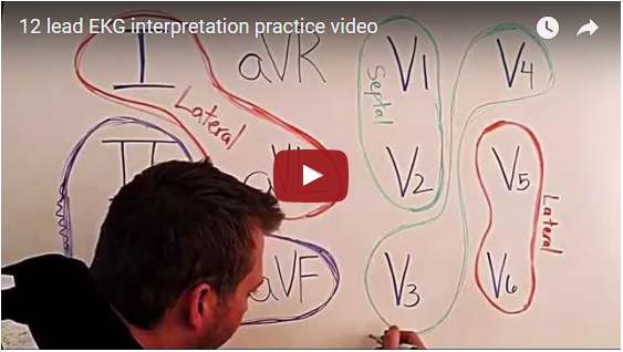 12 Lead EKG Video